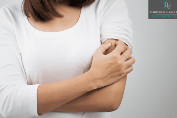 Medical Dermatology in Branson