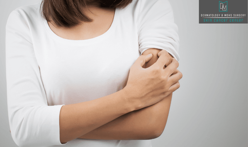 Medical Dermatology in Branson