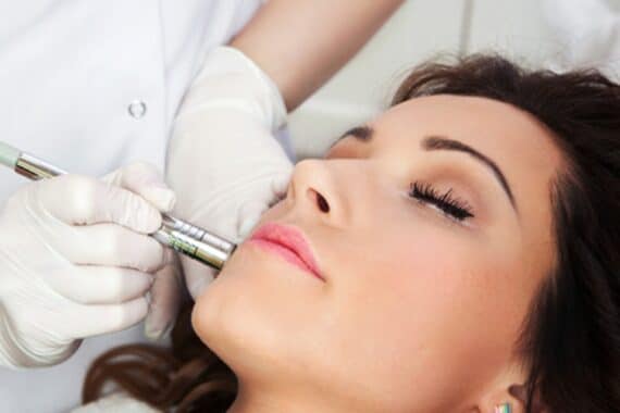 Understanding the Pros and Cons of Surgical Dermatology in Treating Acne Scars