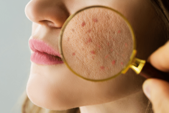 Revitalize Your Skin: The Latest Dermatology Treatments in Springfield