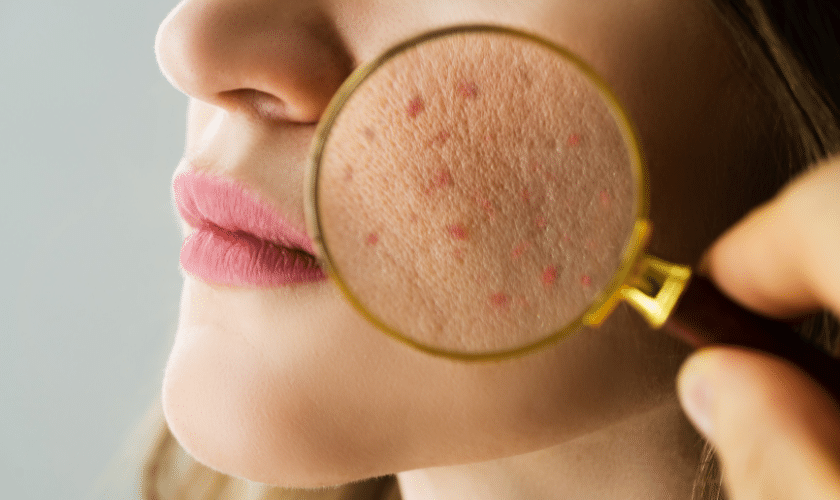 Revitalize Your Skin: The Latest Dermatology Treatments in Springfield