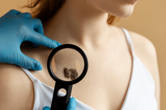 Your Skin And Mohs Surgery: Essential Information For Patients