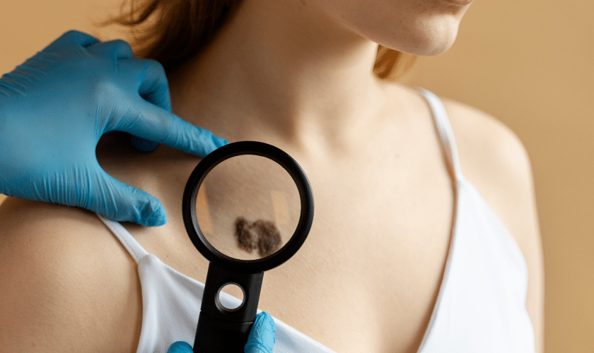 Your Skin And Mohs Surgery: Essential Information For Patients