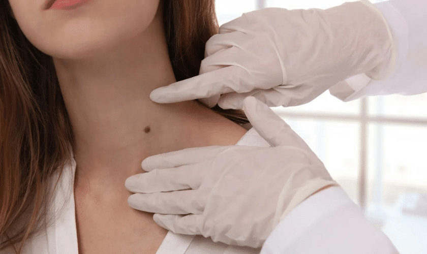 Is Mohs Surgery the Best Treatment for Skin Cancer