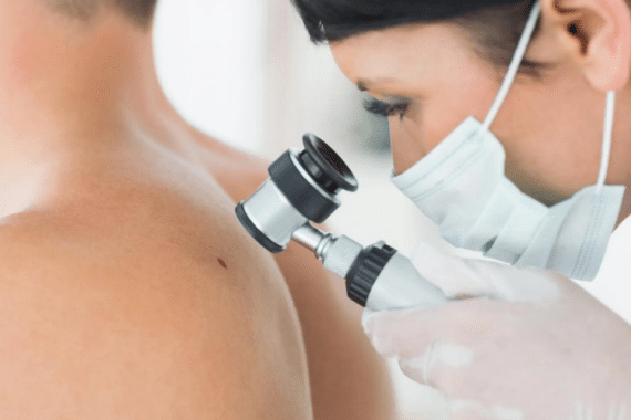 Post-Surgical Care for Basal Cell Carcinoma Tips for Optimal Healing