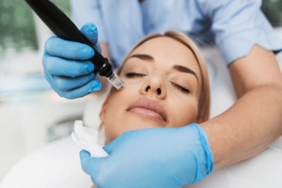 juvederm for a natural-looking transformation in cosmetic dermatology