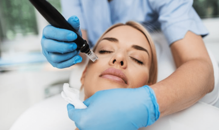 juvederm for a natural-looking transformation in cosmetic dermatology