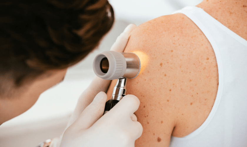 surgical dermatology to approach melanoma management
