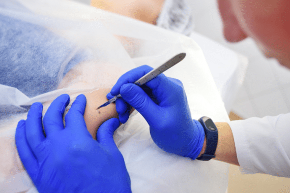 the role of technology in surgical dermatology