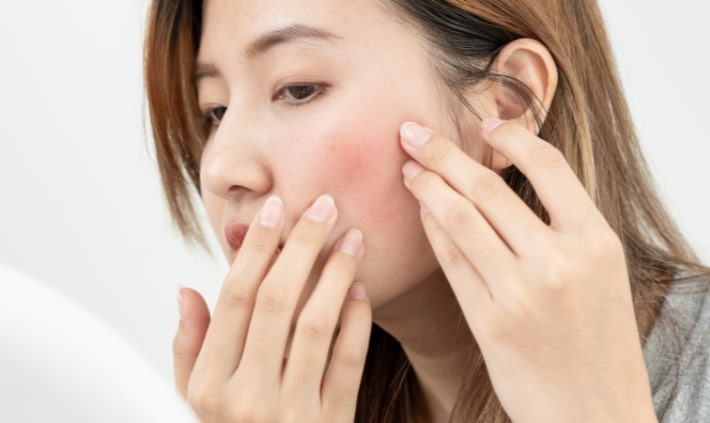 tricks to tame redness for your halloween look